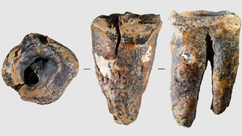 Az ősi szibériai fog felfedi a Neandervölgyiek meglepően fejlett fogászatát